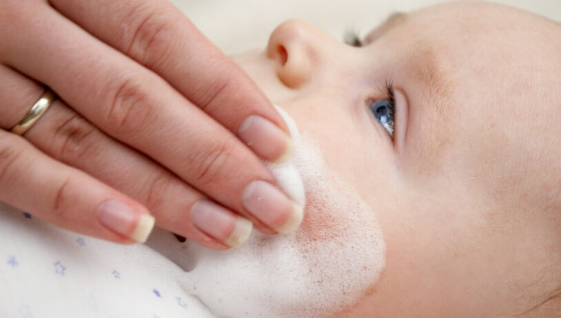 Liječenje akni kod beba i djece