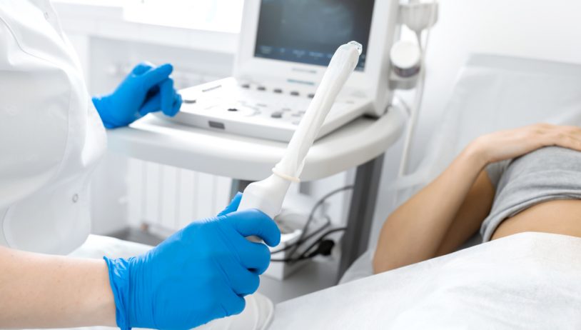 Ginekolog se priprema za vaginalni pregled u trudnoći
