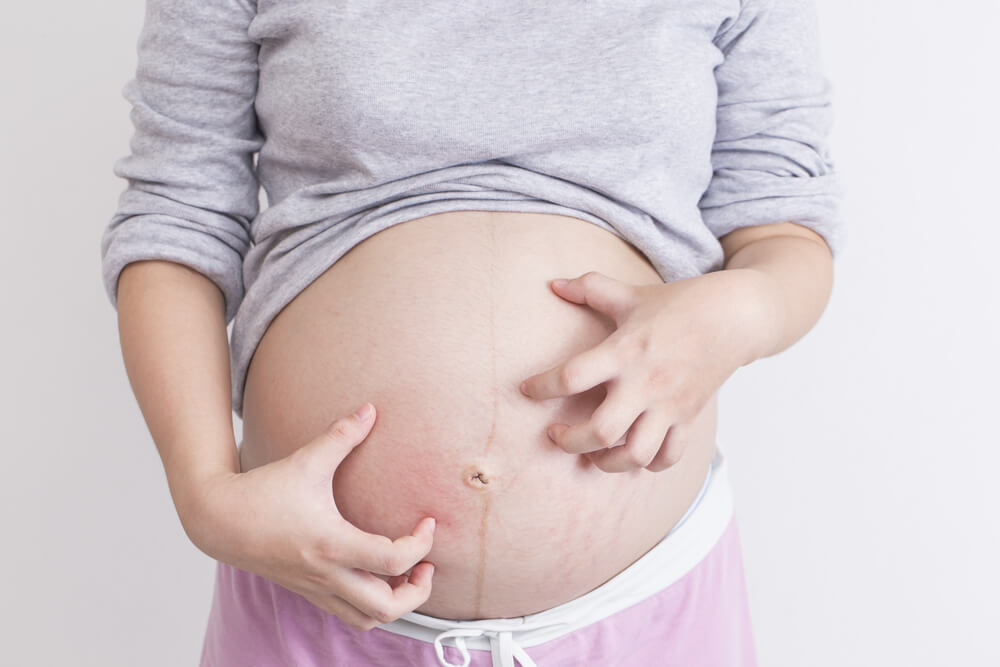 Svrbež kože u trudnoći