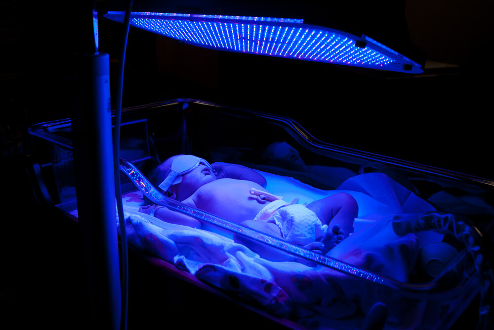 Novorođenče pod fototerapijom (UV svijetlom)