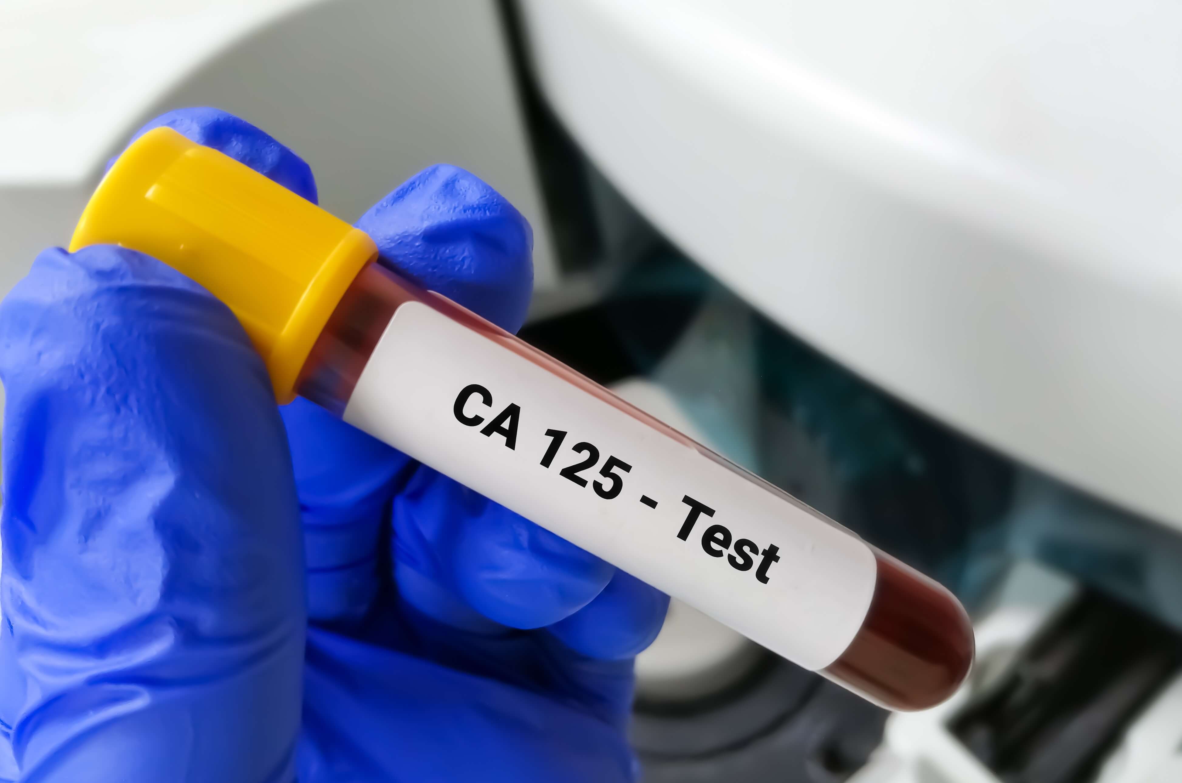CA 125 tumorski marker
