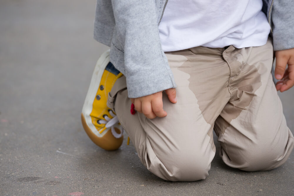 Urinarna inkontinencija kao jedan od simptoma neurogenog mjehura