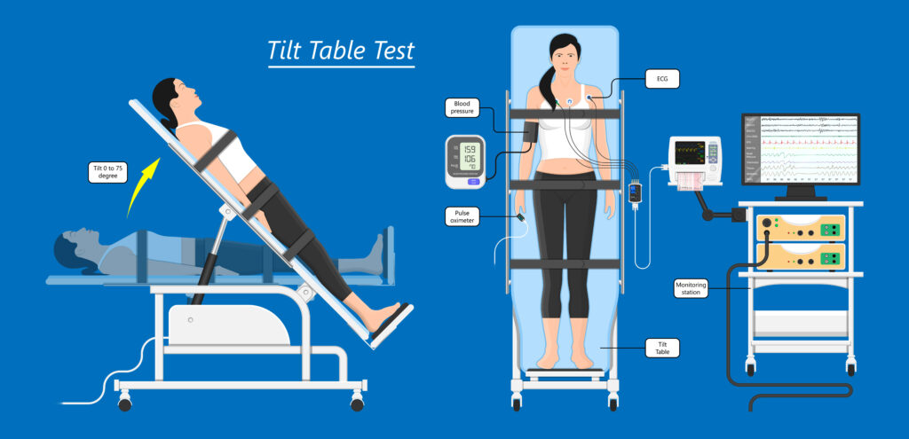 Tilt table test prikaz